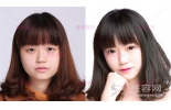 平凡不是你的人生目标,师生整形全线8.8折