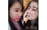 名医专属定制，人生好走俏，雅美精品项目金秋大赏
